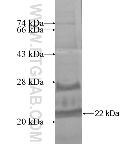 ROBO3 fusion protein Ag13530 SDS-PAGE ROBO3 fusion protein Ag13530 SDS-PAGE