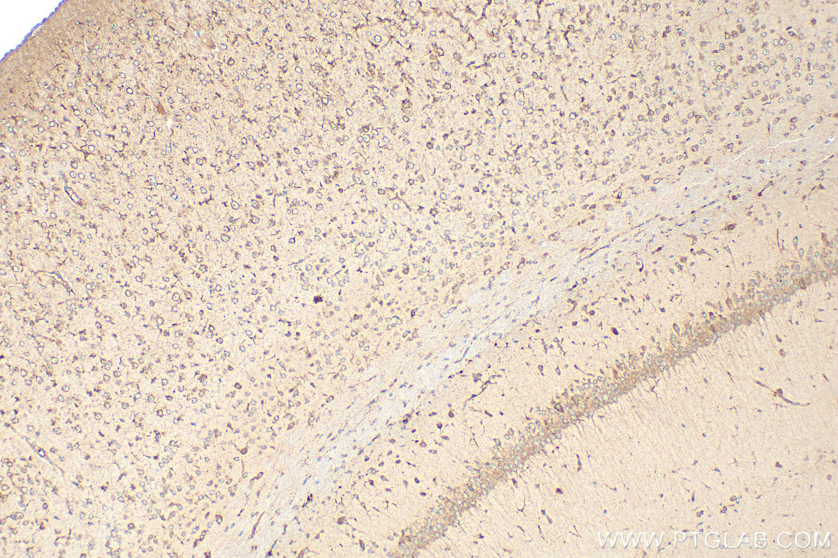 IHC staining of mouse brain using 20220-1-AP