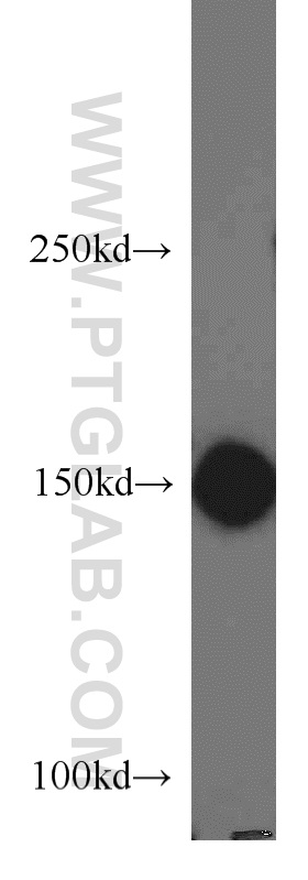 ROCK1 Polyclonal antibody