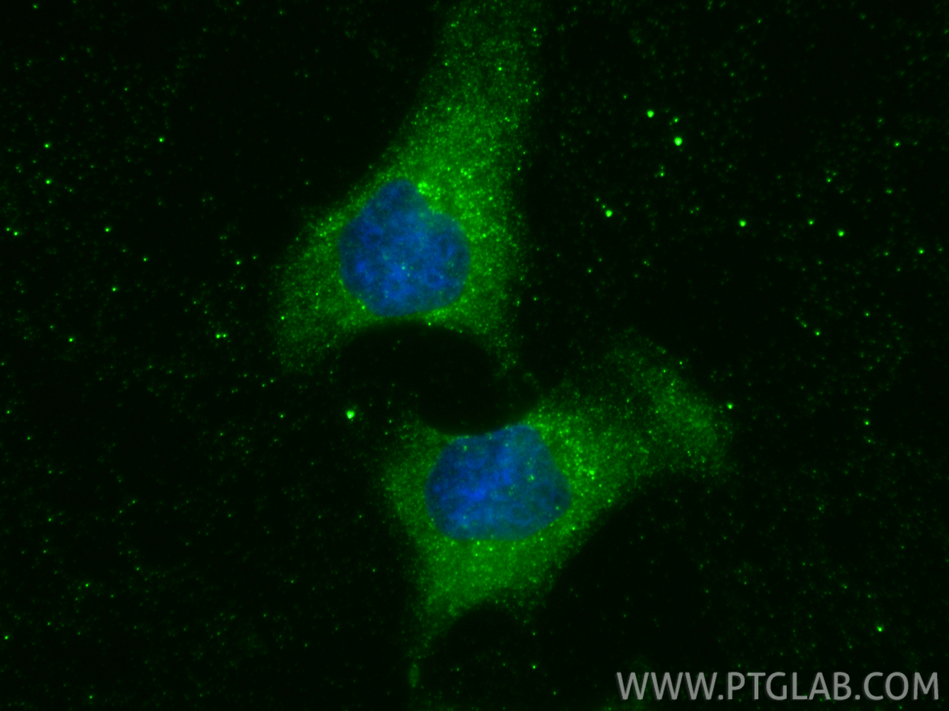IF Staining of HeLa using 66782-1-Ig IF Staining of HeLa using 66782-1-Ig
