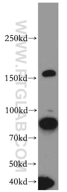 WB analysis of HeLa using 20247-1-AP