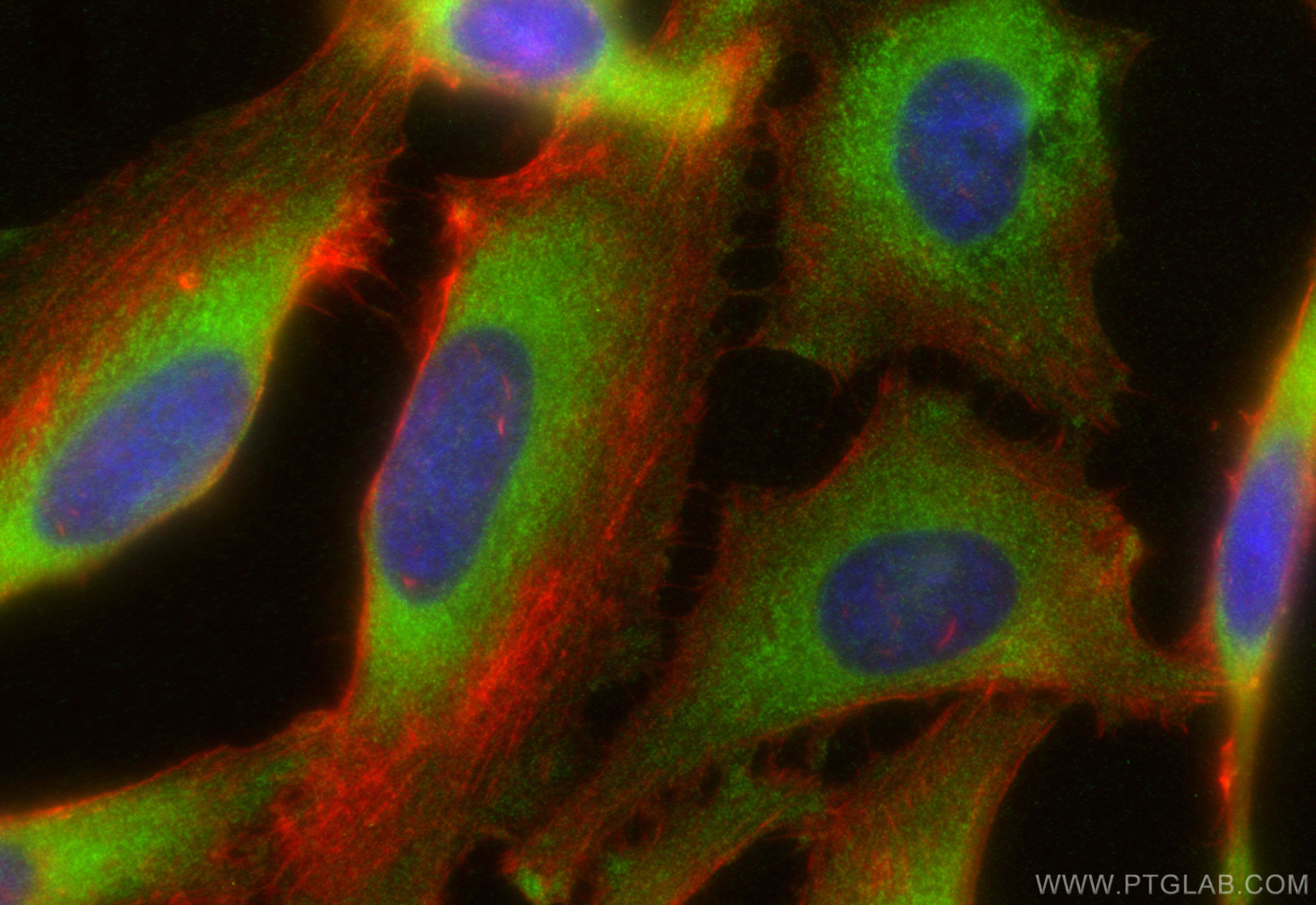 Immunofluorescent analysis of (-20°C Ethanol) fixed HeLa cells using ROCK2(middle) antibody (21645-1-AP) at dilution of 1:200 and Multi-rAb CoraLite ® Plus 750-Goat Anti-Rabbit Recombinant Secondary Antibody (H+L) (RGAR006), CL594-phalloidin (red). IF Staining of HeLa using 21645-1-AP