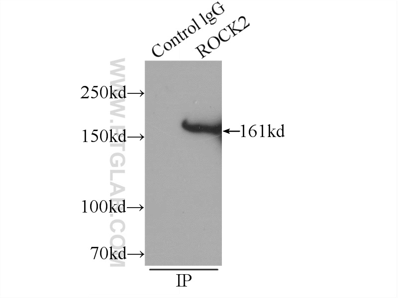 IP experiment of HeLa using 21645-1-AP