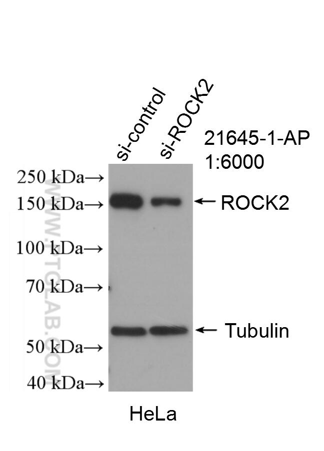 WB analysis of HeLa using 21645-1-AP