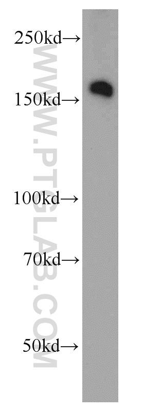 WB analysis of HT-1080 using 21645-1-AP