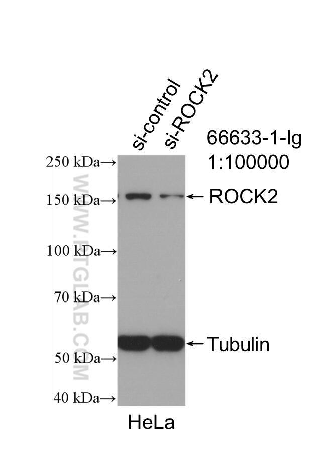 WB analysis of HeLa using 66633-1-Ig