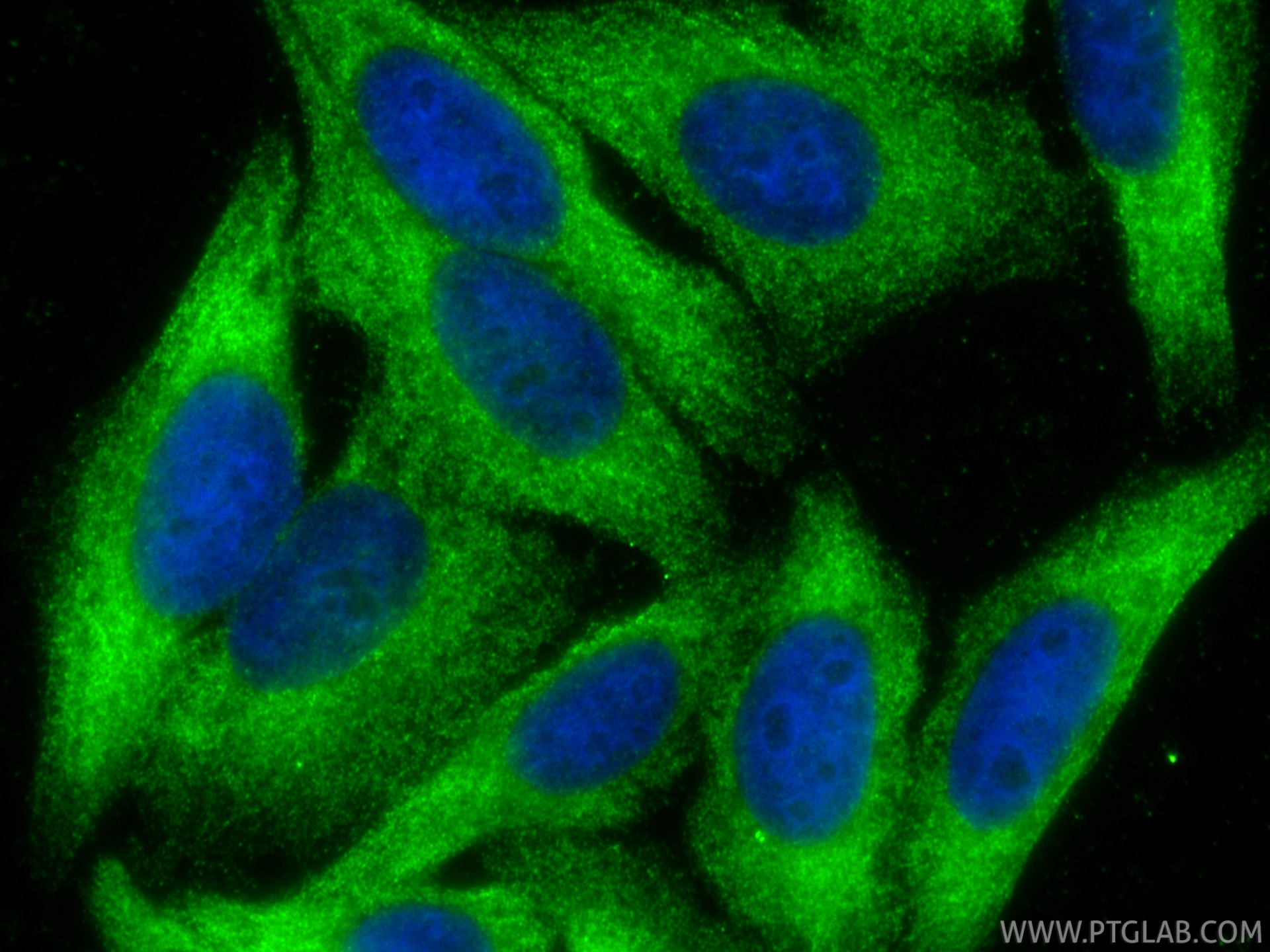 IF Staining of HepG2 using 20248-1-AP IF Staining of HepG2 using 20248-1-AP