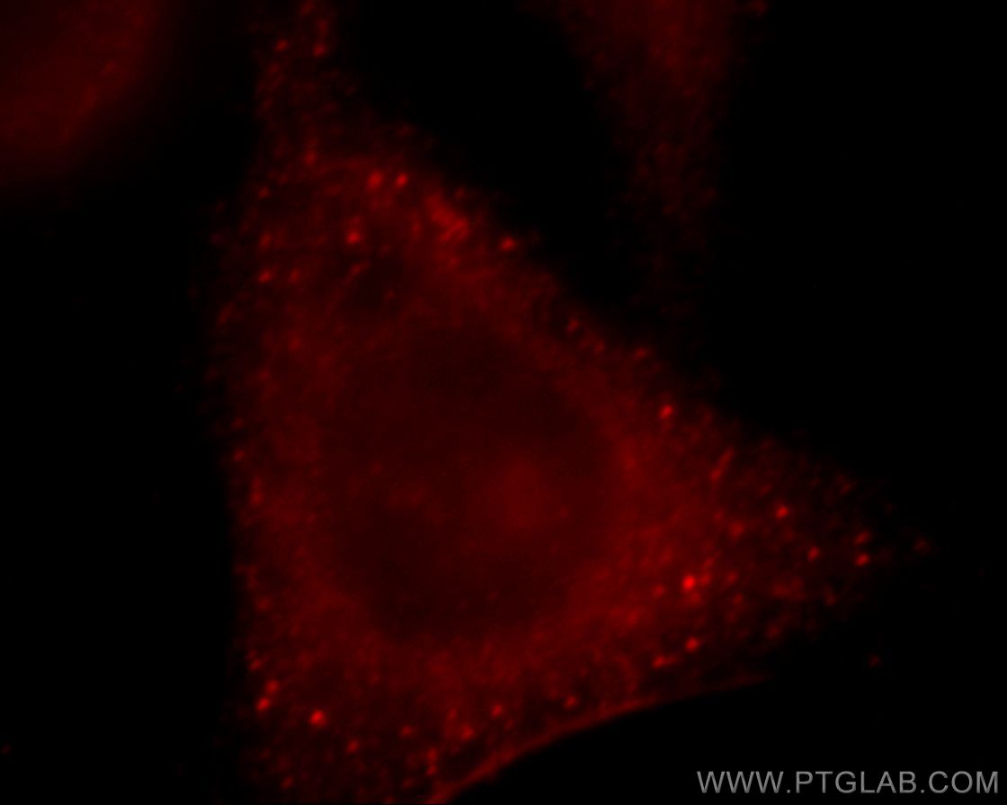 IF Staining of HepG2 using 20248-1-AP (same clone as 20248-1-PBS)