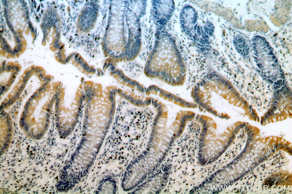 IHC staining of human colon using 20248-1-AP