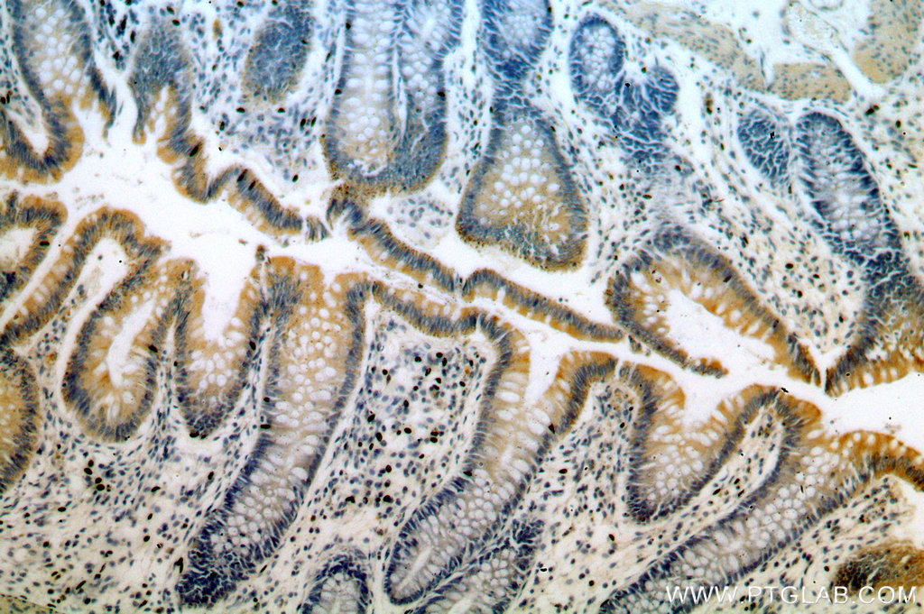IHC staining of human colon using 20248-1-AP (same clone as 20248-1-PBS)
