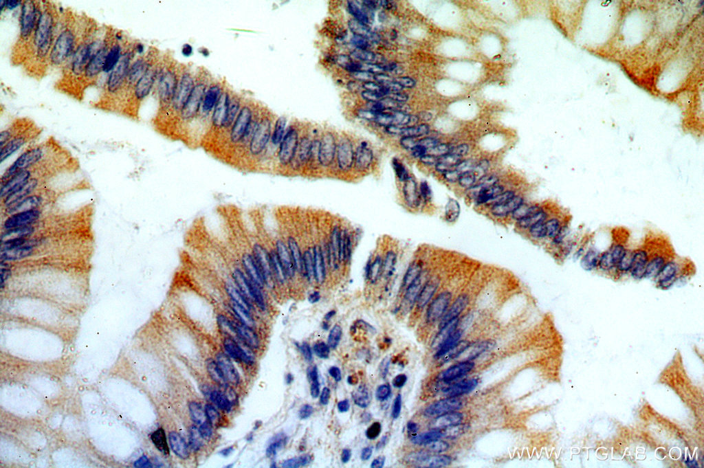 IHC staining of human colon using 20248-1-AP (same clone as 20248-1-PBS)