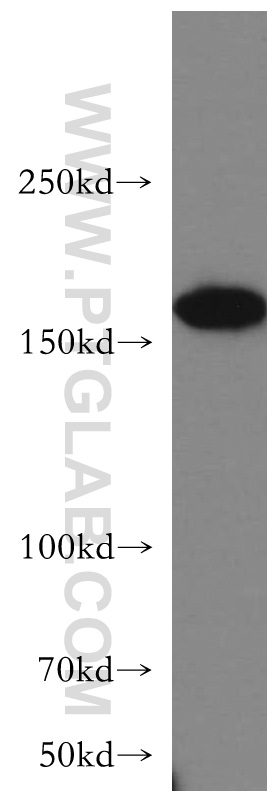 WB analysis of HeLa using 20248-1-AP (same clone as 20248-1-PBS)