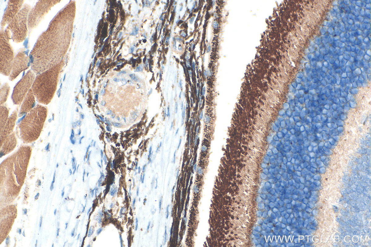 IHC staining of mouse eye using 21984-1-AP
