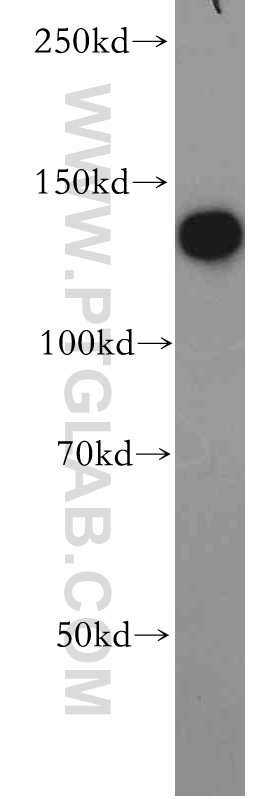 WB analysis of K-562 using 20629-1-AP