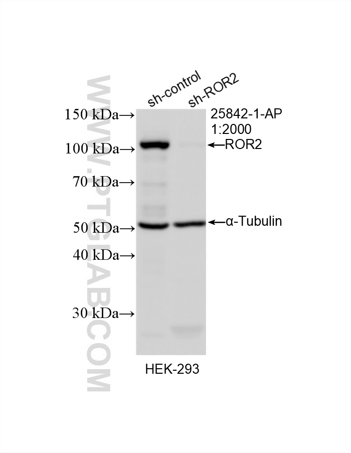 WB result of ROR2 antibody (25842-1-AP; 1:2000; incubated at room temperature for 1.5 hours) with sh-Control and sh-ROR2 transfected HEK-293 cells. WB analysis of HEK-293 using 25842-1-AP