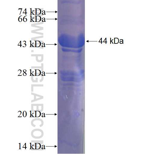 ROR2 fusion protein Ag22959 SDS-PAGE