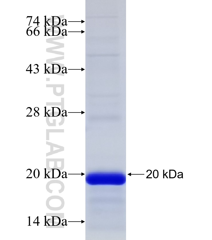 RORA fusion protein Ag32574 SDS-PAGE RORA fusion protein Ag32574 SDS-PAGE