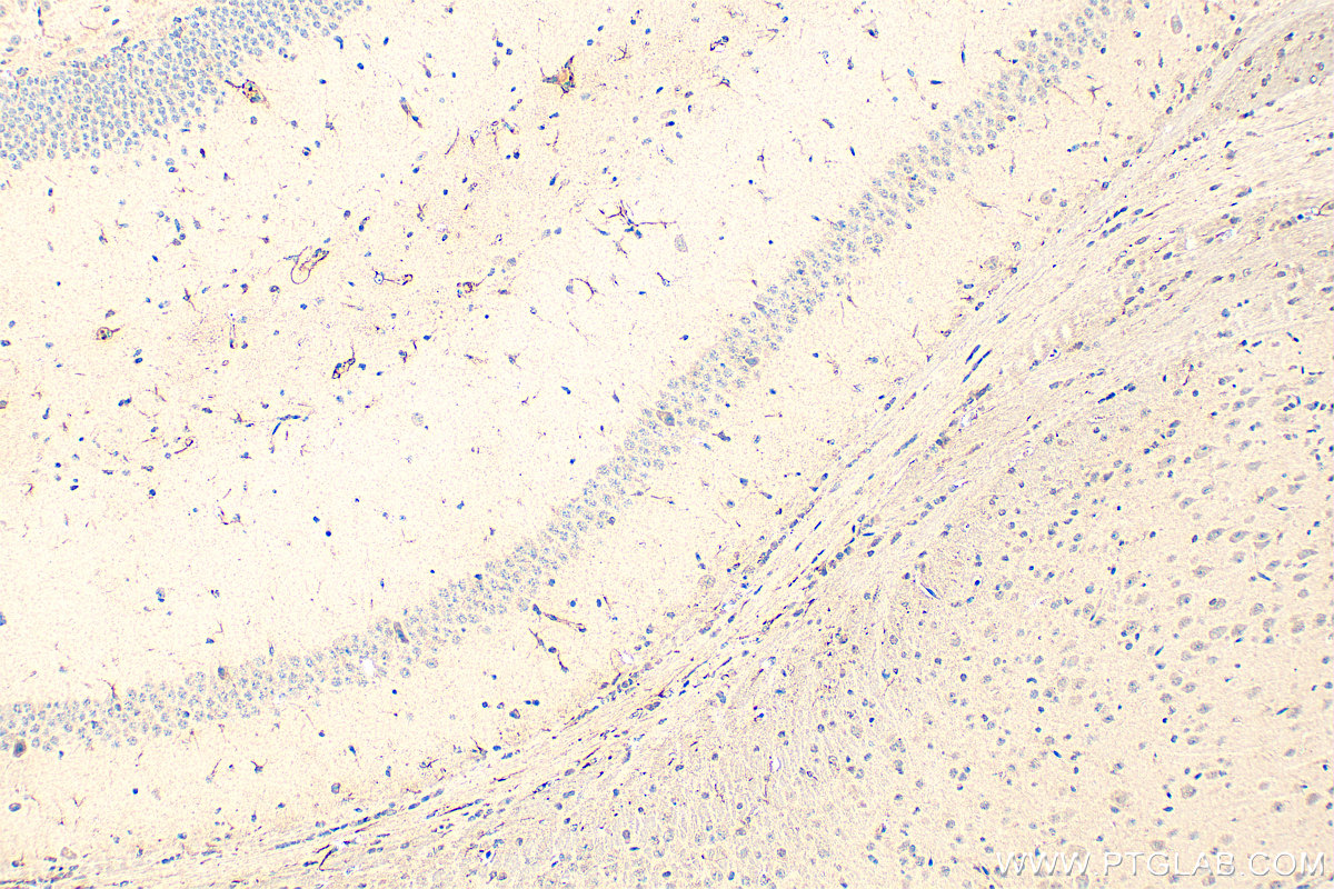 Immunohistochemical analysis of paraffin-embedded mouse brain tissue slide using 17635-1-AP (RORB antibody) at dilution of 1:200 (under 10x lens). Heat mediated antigen retrieval with Tris-EDTA buffer (pH 9.0). IHC staining of mouse brain using 17635-1-AP