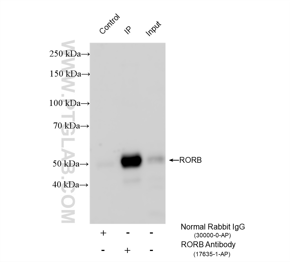 IP result of anti-RORB (IP:17635-1-AP, 4ug; Detection:17635-1-AP 1:500) with mouse eye tissue lysate 2680 ug. IP experiment of mouse eye using 17635-1-AP