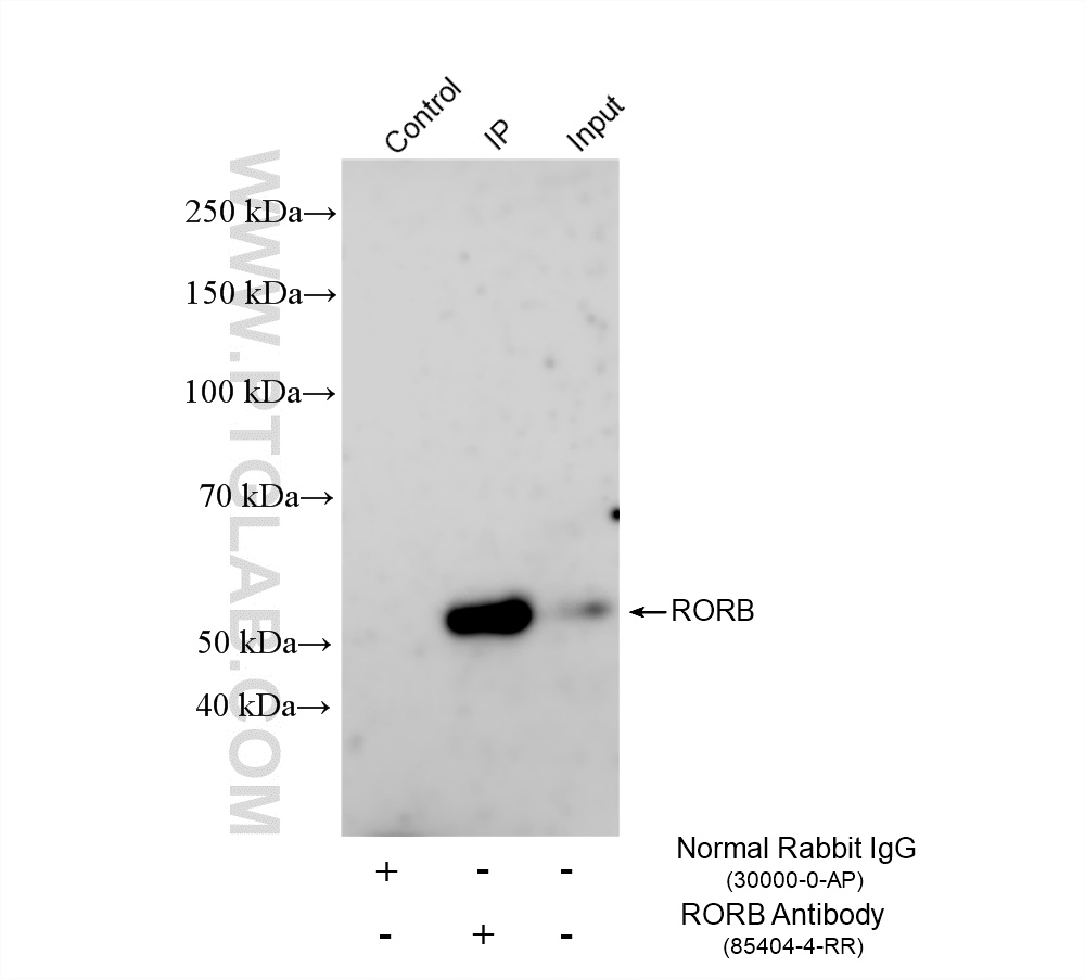 IP experiment of mouse eye using 85404-4-RR
