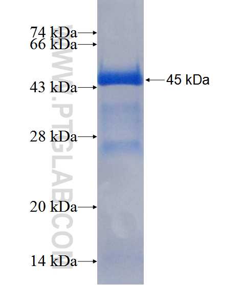 RORB fusion protein Ag11925 SDS-PAGE RORB fusion protein Ag11925 SDS-PAGE