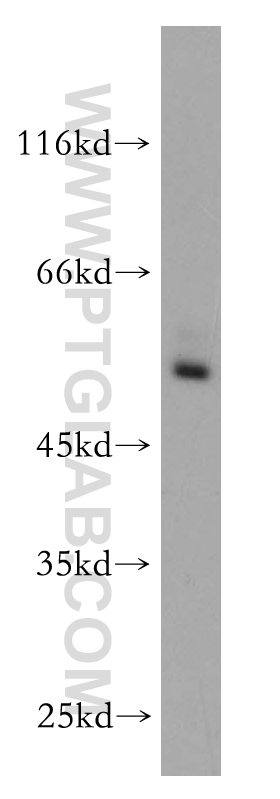 RORC Polyclonal antibody