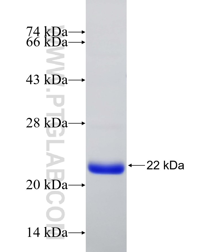 RORC fusion protein Ag31767 SDS-PAGE RORC fusion protein Ag31767 SDS-PAGE