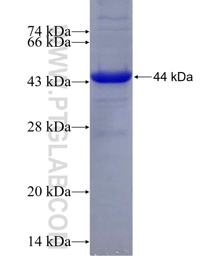 RORC fusion protein Ag6921 SDS-PAGE RORC fusion protein Ag6921 SDS-PAGE