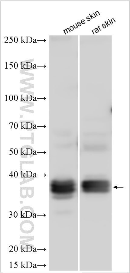 WB analysis using 11572-1-AP