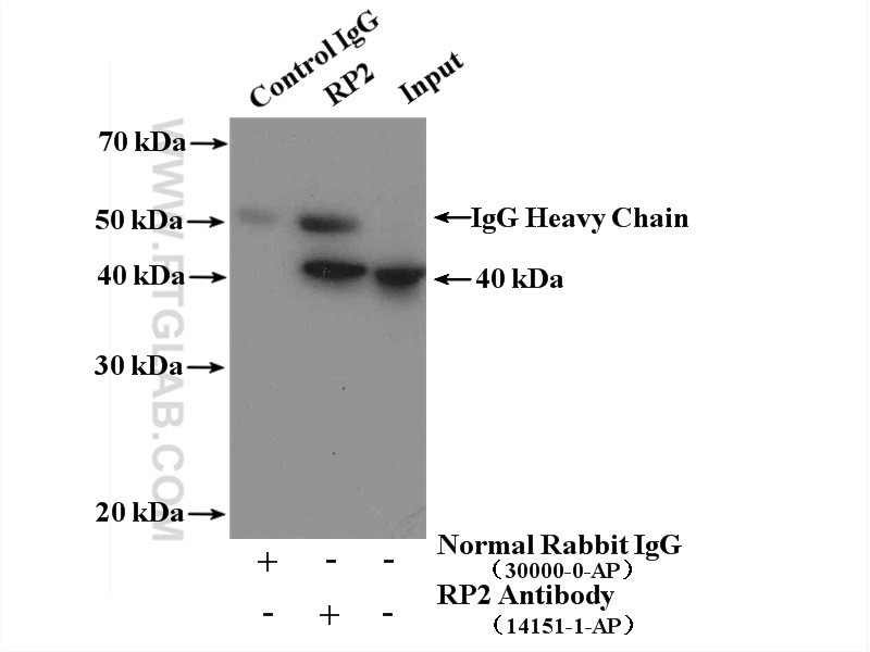 IP experiment of Y79 using 14151-1-AP