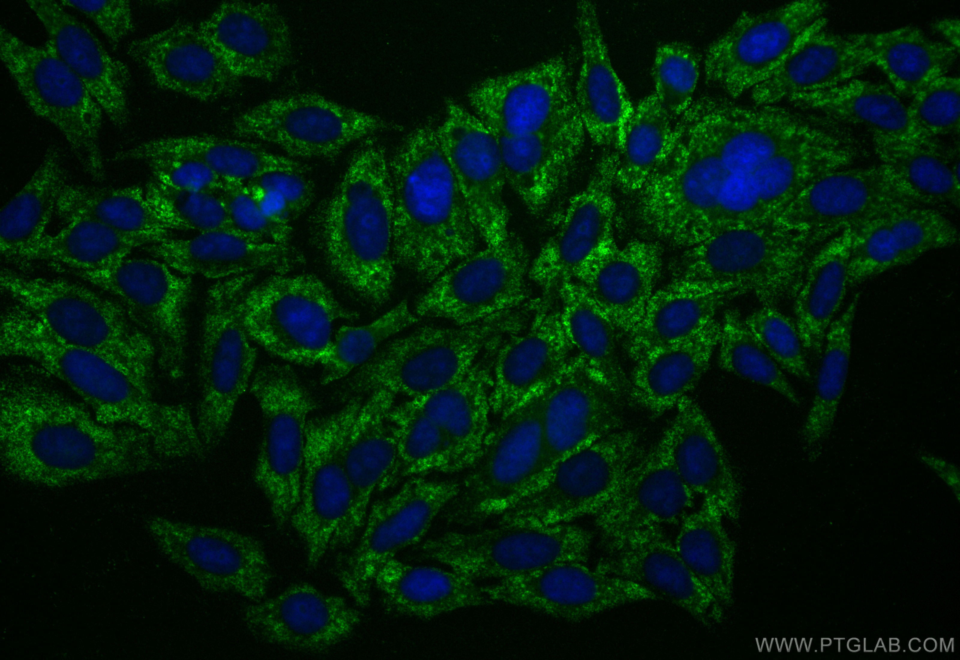 Immunofluorescent analysis of (-20°C Ethanol) fixed HepG2 cells using CoraLite® Plus 488 RP2 antibody (CL488-67795, Clone: 1G2A9 ) at dilution of 1:200. IF Staining of HepG2 using CL488-67795