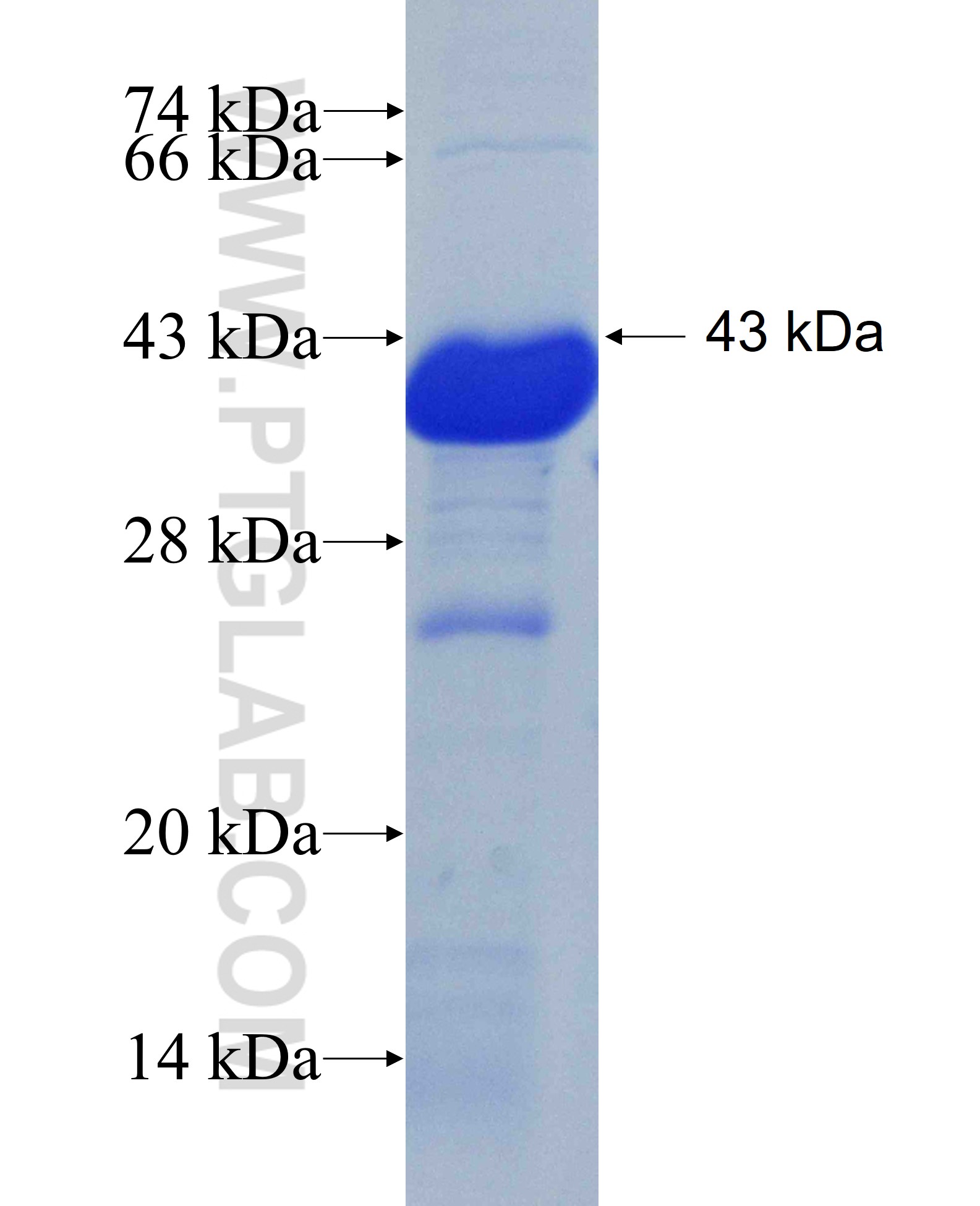 RP2 fusion protein Ag5630 SDS-PAGE