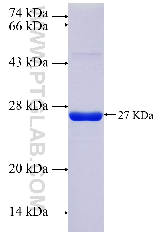 RP3-402G11.5 fusion protein Ag35979 SDS-PAGE RP3-402G11.5 fusion protein Ag35979 SDS-PAGE