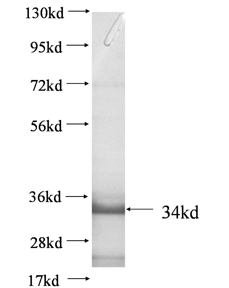 RP5-1022P6.2 fusion protein Ag0526 SDS-PAGE