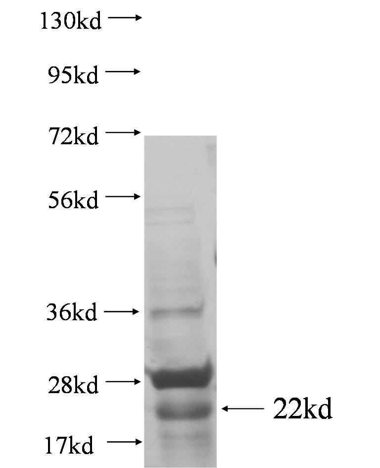 RP5-1022P6.2 fusion protein Ag0796 SDS-PAGE