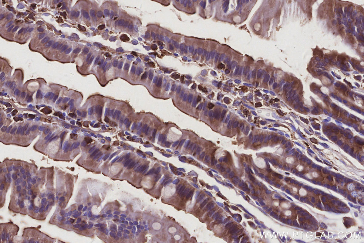 IHC staining of mouse small intestine using 10847-1-AP IHC staining of mouse small intestine using 10847-1-AP