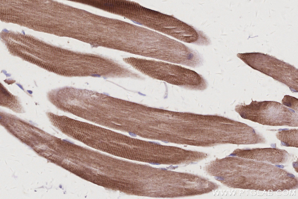 IHC staining of mouse skeletal muscle using 10847-1-AP IHC staining of mouse skeletal muscle using 10847-1-AP