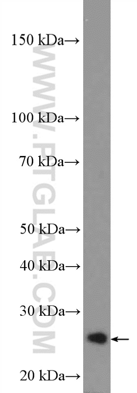 WB analysis of HeLa using 16832-1-AP