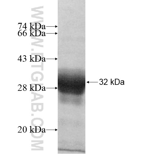 RP9 fusion protein Ag10389 SDS-PAGE RP9 fusion protein Ag10389 SDS-PAGE