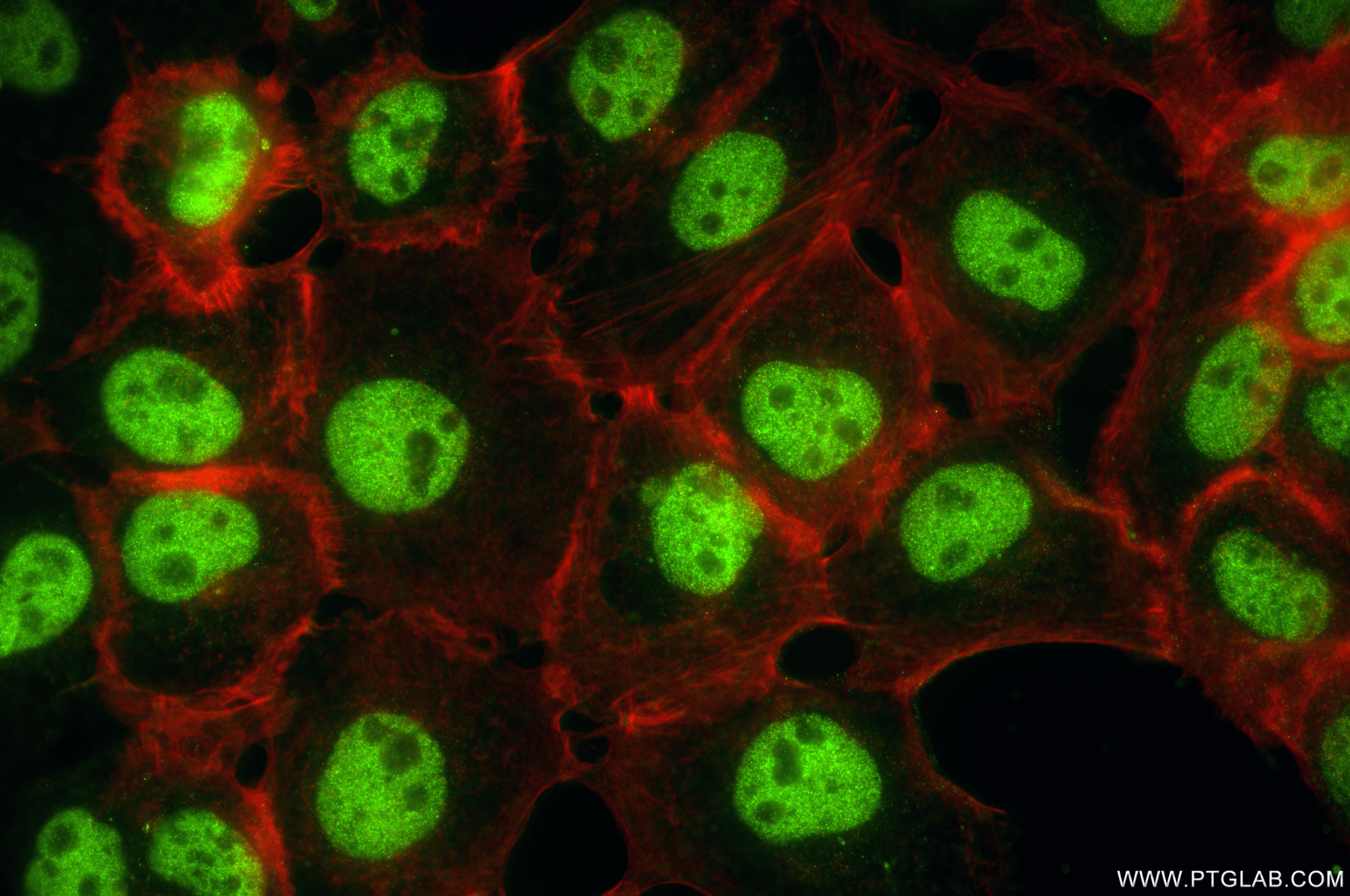 IF Staining of A431 using 87254-1-RR