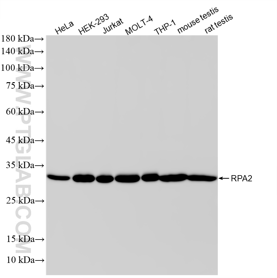 WB analysis using 87254-1-RR