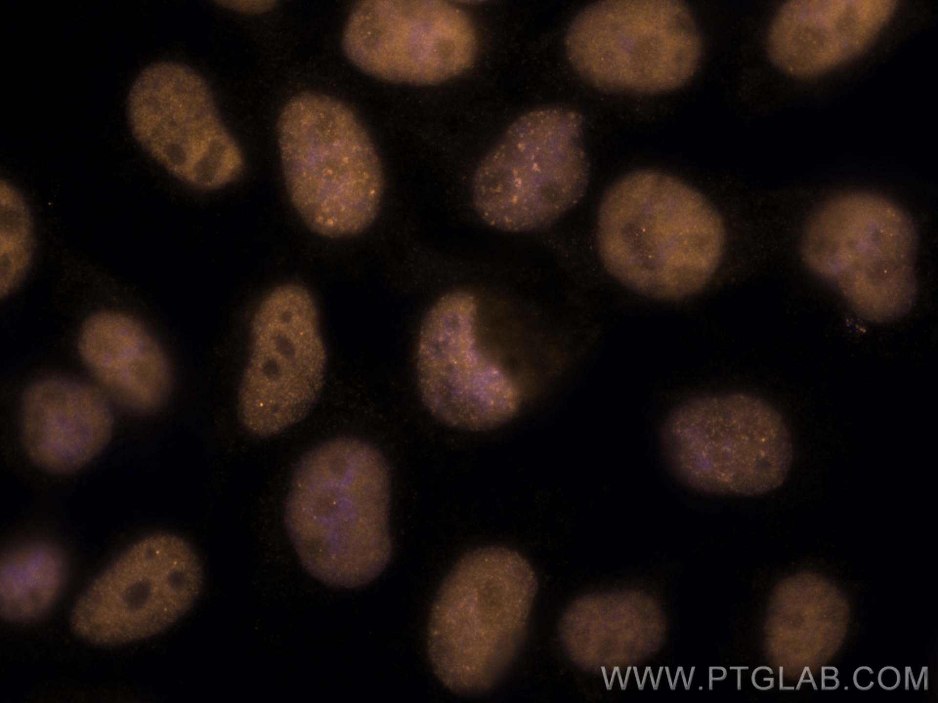 IF Staining of A431 using CL555-67999