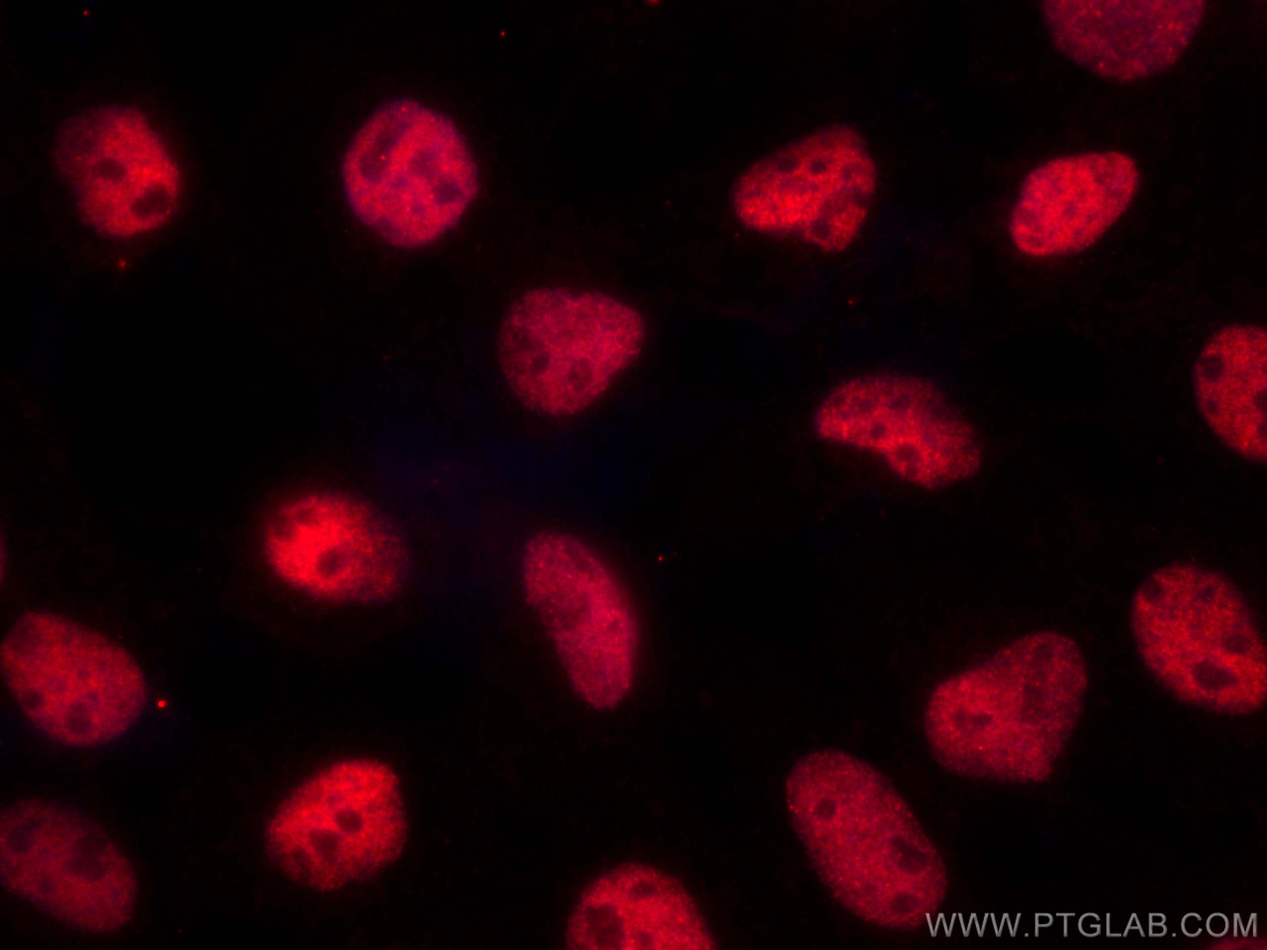 IF Staining of A431 using CL594-67999