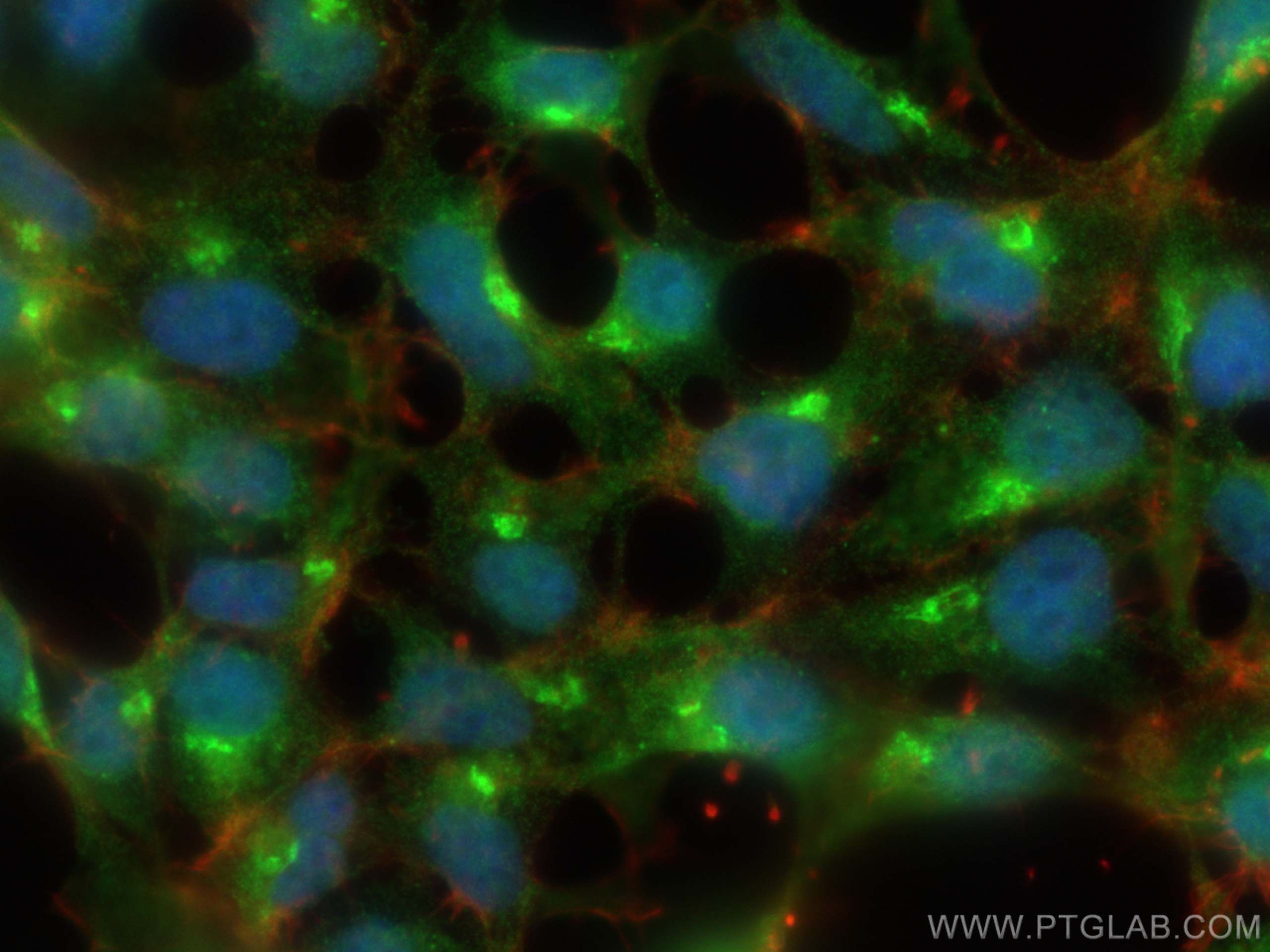 IF Staining of HEK-293 using 17401-1-AP