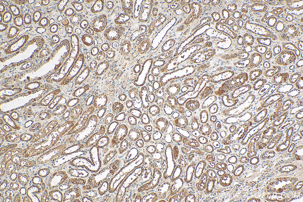 IHC staining of human kidney using 17401-1-AP