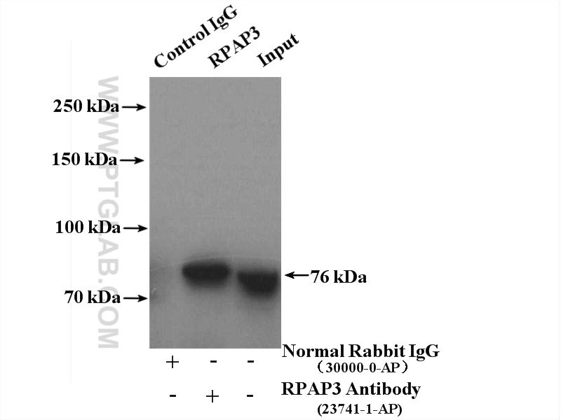 IP experiment of HEK-293 using 23741-1-AP