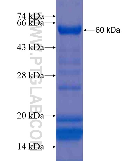 RPAP3 fusion protein Ag20661 SDS-PAGE