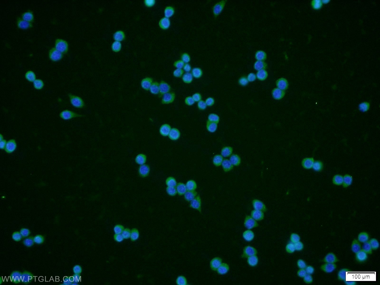 IF Staining of RAW 264.7 using 12168-2-AP