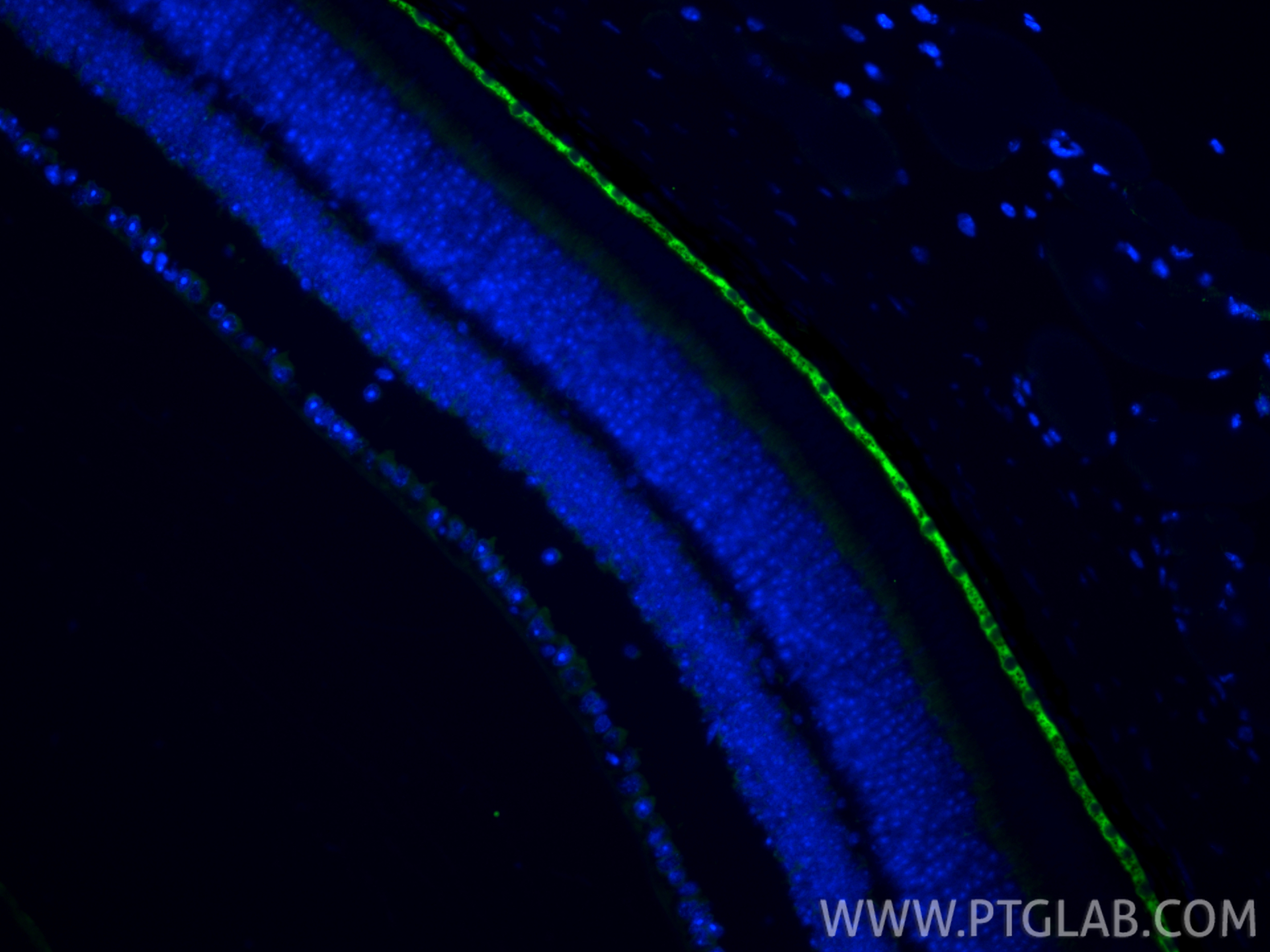 IF Staining of mouse eye using 17939-1-AP IF Staining of mouse eye using 17939-1-AP
