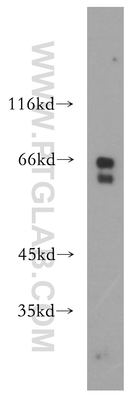 WB analysis of Y79 using 17939-1-AP